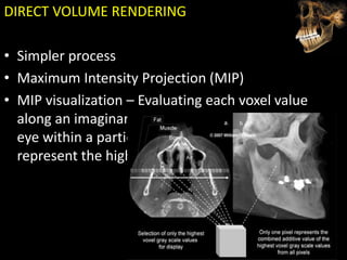 Pmct Volume Rendering Cbct | PPTX