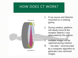 HOW DOES CT WORK?
1. X-ray source and detector
mounted on a rotating
gantry.
2. During rotation, platform
will slowly move & the
receptor detects x rays
attenuated by the patient.
3. multiple images will be
captured during rotation.
4. “ raw data ” reconstructed
by a computer algorithm to
generate cross-sectional
images.
 