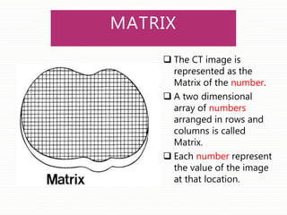MATRIX
 The CT image is
represented as the
Matrix of the number.
 A two dimensional
array of numbers
arranged in rows and
columns is called
Matrix.
 Each number represent
the value of the image
at that location.
 