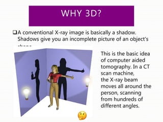WHY 3D?
A conventional X-ray image is basically a shadow.
Shadows give you an incomplete picture of an object's
shape.
This is the basic idea
of computer aided
tomography. In a CT
scan machine,
the X-ray beam
moves all around the
person, scanning
from hundreds of
different angles.
 