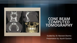 CONE BEAM
COMPUTED
TOMOGRAPHY
Guided by: Dr. Navneet Sharma
Presentation by: Ayushi Gautam
 