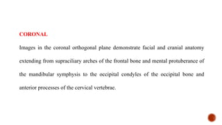 CORONAL
Images in the coronal orthogonal plane demonstrate facial and cranial anatomy
extending from supraciliary arches of the frontal bone and mental protuberance of
the mandibular symphysis to the occipital condyles of the occipital bone and
anterior processes of the cervical vertebrae.
 
