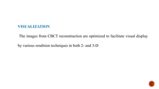 VISUALIZATION
The images from CBCT reconstruction are optimized to facilitate visual display
by various rendition techniques in both 2- and 3-D
 
