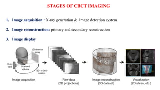 STAGES OF CBCT IMAGING
1. Image acquisition : X-ray generation & Image detection system
2. Image reconstruction: primary and secondary rconstruction
3. Image display
 