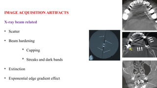 IMAGE ACQUISITION ARTIFACTS
X-ray beam related
• Scatter
• Beam hardening
* Cupping
* Streaks and dark bands
• Extinction
• Exponential edge gradient effect
 