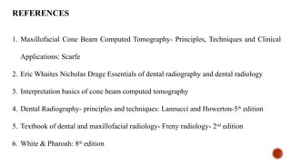 REFERENCES
1. Maxillofacial Cone Beam Computed Tomography- Principles, Techniques and Clinical
Applications: Scarfe
2. Eric Whaites Nicholas Drage Essentials of dental radiography and dental radiology
3. Interpretation basics of cone beam computed tomography
4. Dental Radiography- principles and techniques: Lannucci and Howerton-5th
edition
5. Textbook of dental and maxillofacial radiology- Freny radiology- 2nd
edition
6. White & Pharoah: 8th
edition
 