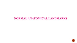 NORMALANATOMICAL LANDMARKS
 