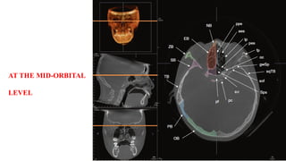 AT THE MID-ORBITAL
LEVEL
 
