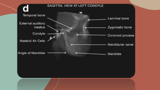 CBCT anatomical structures | PPTX