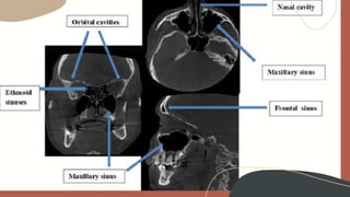 CBCT anatomical structures | PPTX
