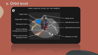 CBCT anatomical structures | PPTX