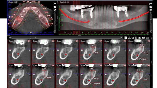 CBCT Basic.pptx