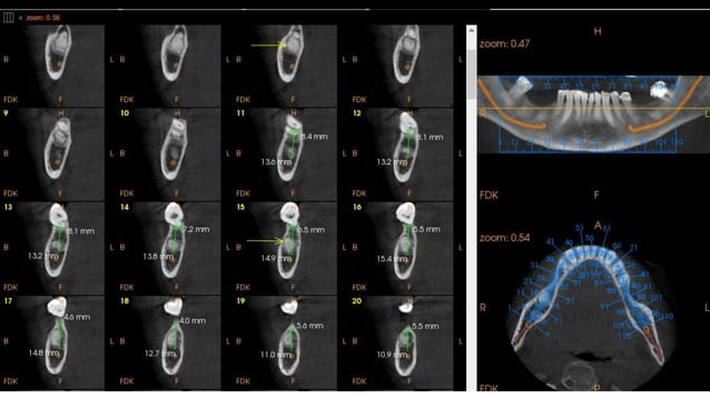 CBCT Basic.pptx