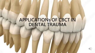 APPLICATIONs OF CBCT IN
DENTAL TRAUMA
 