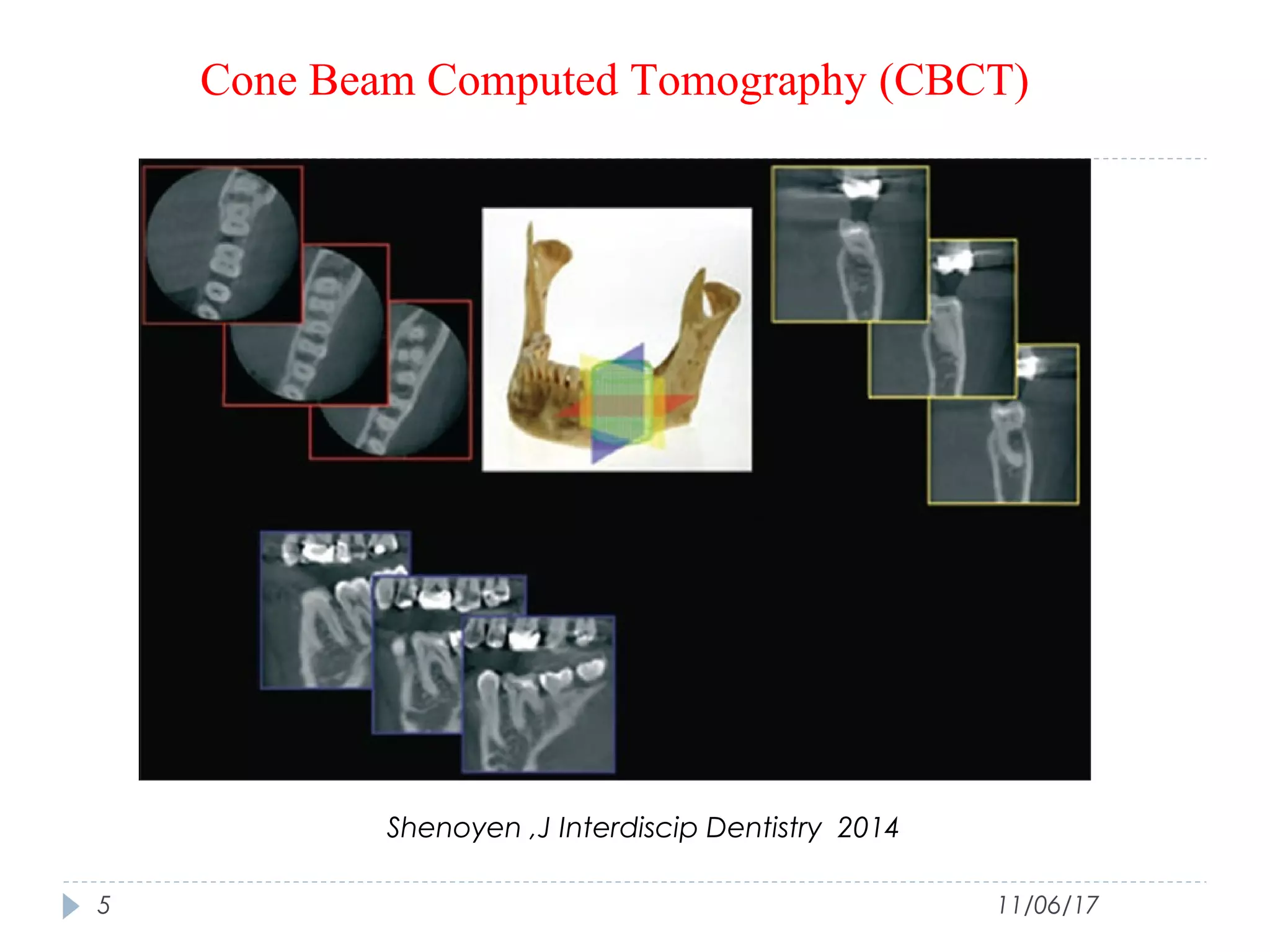 Use of Cone Beam Computed Tomography in Endodontics | PPT
