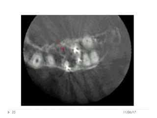 Use of Cone Beam Computed Tomography in Endodontics | PPT