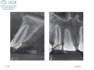 Use of Cone Beam Computed Tomography in Endodontics | PPT