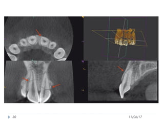 Use of Cone Beam Computed Tomography in Endodontics | PPT