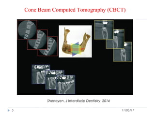 Use of Cone Beam Computed Tomography in Endodontics | PPT