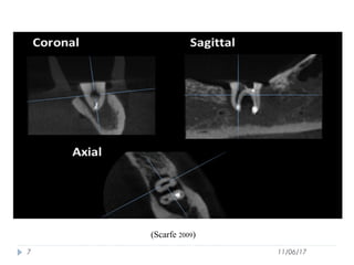 Use of Cone Beam Computed Tomography in Endodontics | PPT