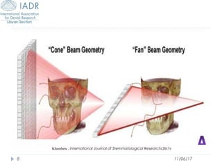 Use of Cone Beam Computed Tomography in Endodontics | PPT