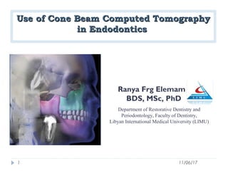 Use of Cone Beam Computed TomographyUse of Cone Beam Computed Tomography
in Endodonticsin Endodontics
Ranya Frg Elemam
BDS, MSc, PhD
Department of Restorative Dentistry and
Periodontology, Faculty of Dentistry,
Libyan International Medical University (LIMU)
11/06/171
 