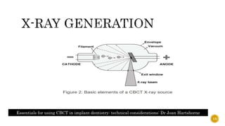 Essentials for using CBCT in implant dentistry: technical considerations: Dr Joan Hartshorne
13
 