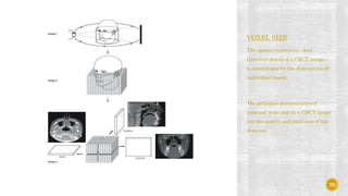VOXEL SIZE
The spatial resolution—and
therefore detail of a CBCT image—
is determined by the dimensions of
individual voxels.
The principal determinants of
nominal voxel size in a CBCT image
are the matrix and pixel size of the
detector.
29
 