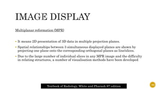 Multiplanar reformation (MPR)
 It means 2D presentation of 3D data in multiple projection planes.
 Spatial relationships between 3 simultaneous displayed planes are shown by
projecting one plane onto the corresponding orthogonal planes as line/slices.
 Due to the large number of individual slices in any MPR image and the difficulty
in relating structures, a number of visualisation methods have been developed
Textbook of Radiology, White and Pharaoh 8th edition
35
 