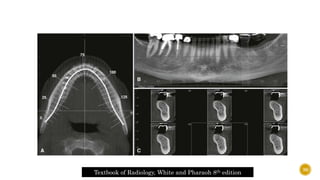 Textbook of Radiology, White and Pharaoh 8th edition
36
 