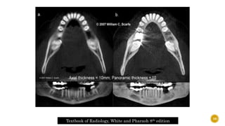 Textbook of Radiology, White and Pharaoh 8th edition
38
 