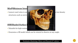 MinP(Minimum Intensity Projection)
 Lowest voxel value is sampled and the presentation stresses on low density
structures such as nerve canals.
SSR(Shaded Surface Rendering)
 Valuable for high-contrast imaging such as bone
 Generates a 3D model which can be rotated to observe at any angle.
Textbook of Radiology, White and Pharaoh 8th edition
41
 