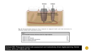 Scherer MD. Presurgical implant-site assessment and restoratively driven digital planning. Dental
Clinics. 2014 Jul 1;58(3):561-95.
54
 