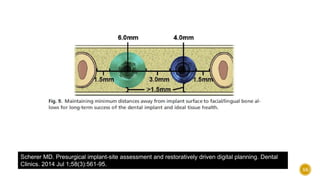 Scherer MD. Presurgical implant-site assessment and restoratively driven digital planning. Dental
Clinics. 2014 Jul 1;58(3):561-95.
55
 