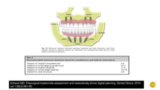 Scherer MD. Presurgical implant-site assessment and restoratively driven digital planning. Dental Clinics. 2014
Jul 1;58(3):561-95.
56
 