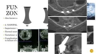  Also known as the “traumatic zone”
 2. NASOPALATINE / INCISIVE CANAL
 Importance- carries nasopalatine nerve and vessels
 Normal anatomy
 Variations- a) Angulation b) Number
 Complication- if an implant contacts neural tissue in this canal, it could lead
to failure of osseointegration or sensory dysfunction.
62
 