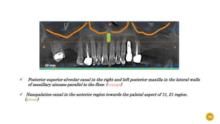 69
 Posterior superior alveolar canal in the right and left posterior maxilla in the lateral walls
of maxillary sinuses parallel to the floor. (orange)
 Nasopalatine canal in the anterior region towards the palatal aspect of 11, 21 region.
(green)
 