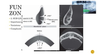  2. SUB-LINGUAL FORAMEN AND CANAL
 Importance- sublingual artery
 Variations-
 Complications-
71
 