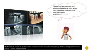 These images are great, but
what am I looking at, and where
can I get more information on
interpreting the
scan????????????
Hartshorne J. Essential guidelines for using cone beam computed tomography (CBCT) in implant dentistry.
Part 2: Clinical considerations. 9
 