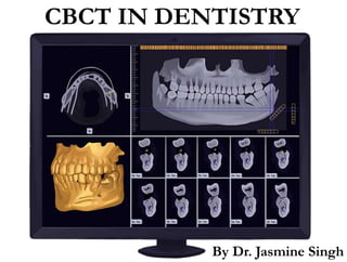CBCT IN DENTISTRY
By Dr. Jasmine Singh
 
