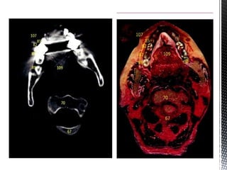 CBCT_INTERPRETATION CBCT APPLICATIONS & READING.pptx