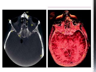 CBCT_INTERPRETATION CBCT APPLICATIONS & READING.pptx