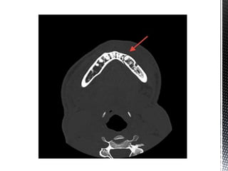 CBCT_INTERPRETATION CBCT APPLICATIONS & READING.pptx