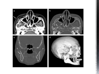CBCT_INTERPRETATION CBCT APPLICATIONS & READING.pptx