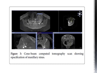 CBCT_INTERPRETATION CBCT APPLICATIONS & READING.pptx