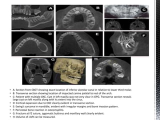 CBCT_INTERPRETATION CBCT APPLICATIONS & READING.pptx