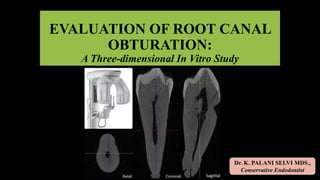 EVALUATION OF ROOT CANAL
OBTURATION:
A Three-dimensional In Vitro Study
Dr. K. PALANI SELVI MDS.,
Conservative Endodontist
 