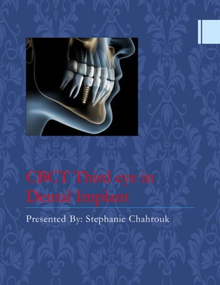 CBCT Third eye in
Dental Implant
Presented By: Stephanie Chahrouk
 
