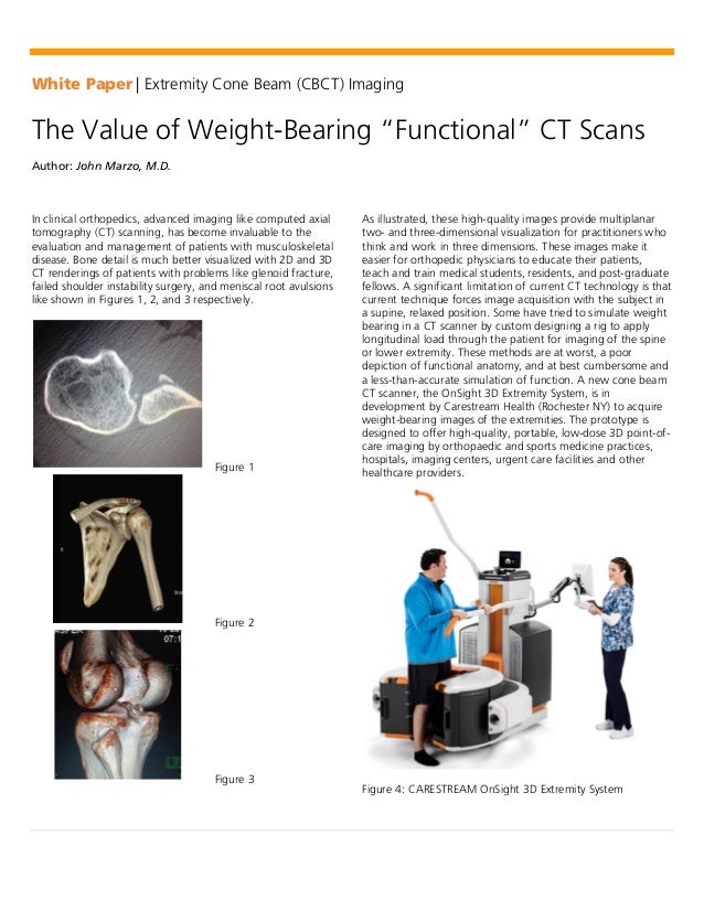 The Value of WeightBearing "Functional" CT Scans in medical imaging