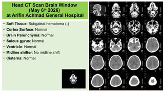 Comprehensive Trauma Case Study: Multidisciplinary Management of a 25 ...